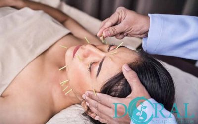 Benefits of aesthetic acupuncture.