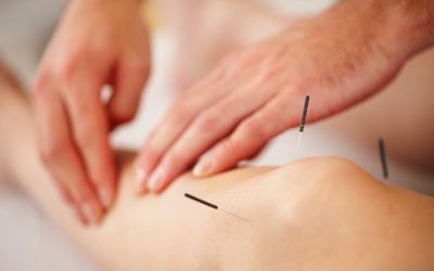 Acupuncture Alleviates Knee Arthritis Confirmed