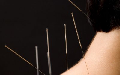 Acupuncture Neck Pain Finding