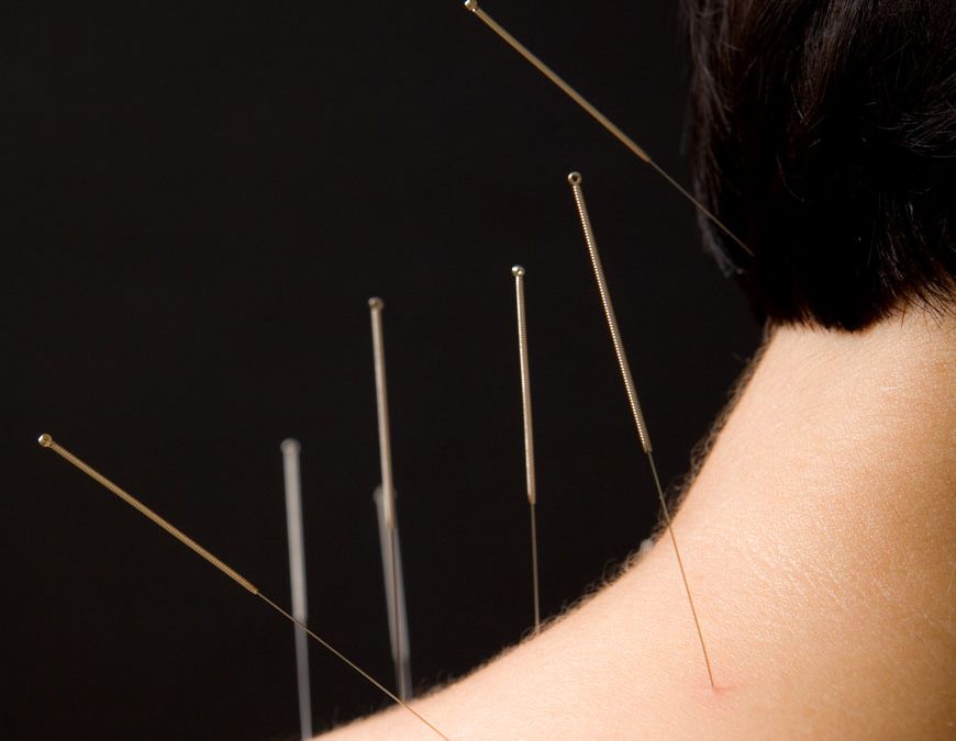 Acupuncture Neck Pain Finding